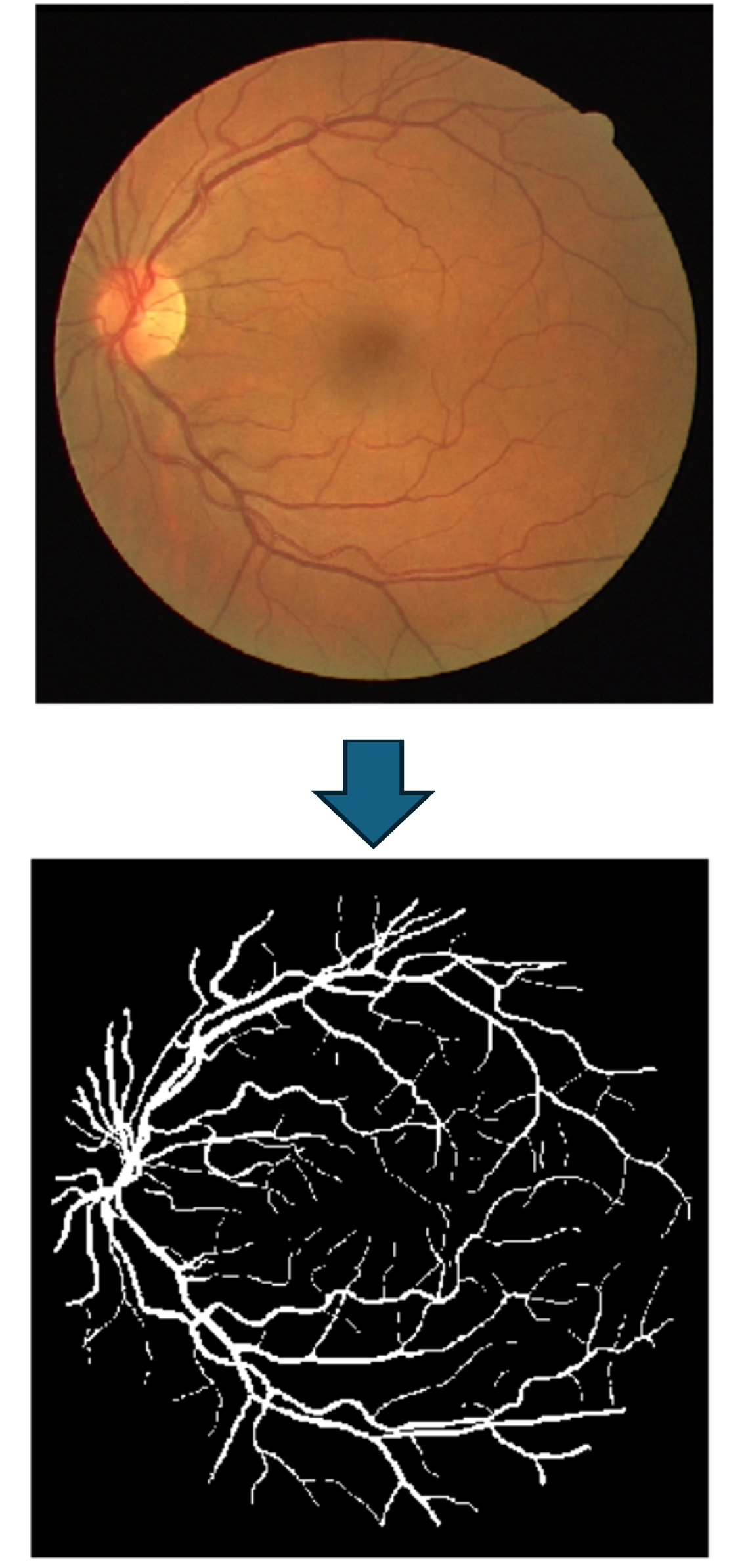 Example of vascular image from the DRIVE dataset.